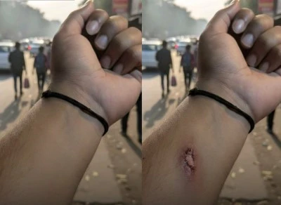 এআই দিয়ে ‘কাটা হাতের’ ছবি বানিয়ে অফিস থেকে ছুটি নিলেন কর্মী